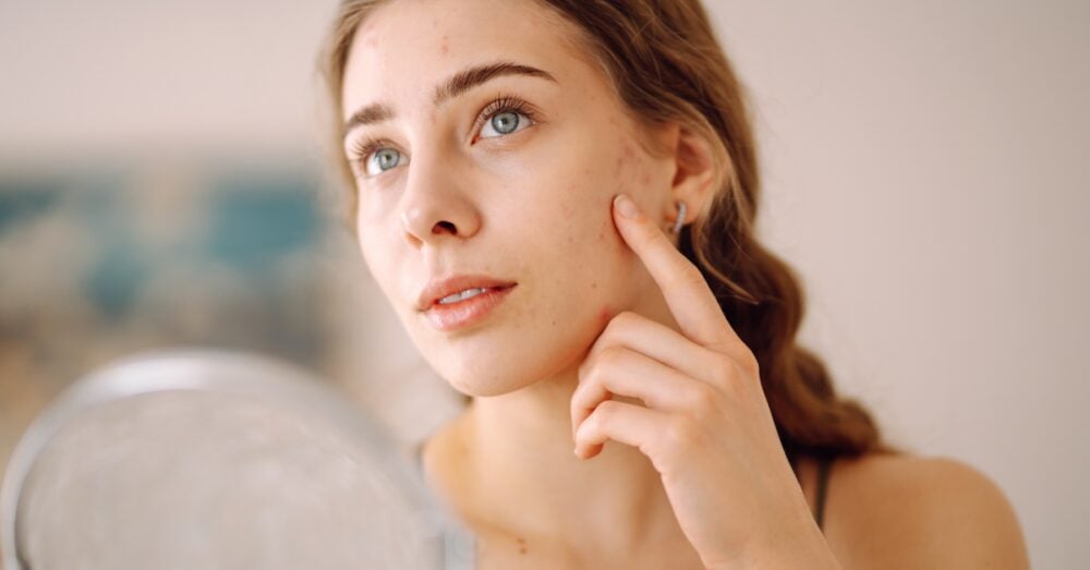 Young woman examining her skin while considering a chemical peel for acne scars in Phoenix