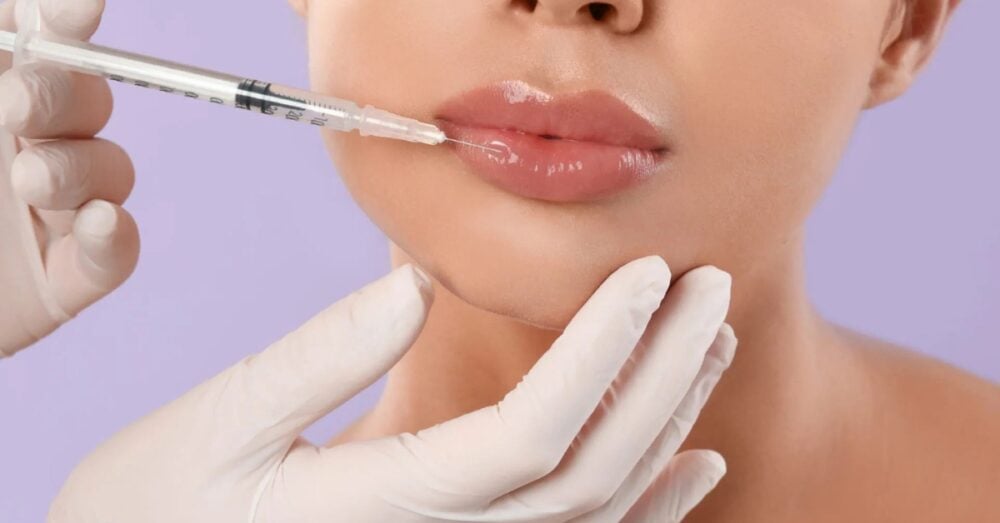 Provider in gloves administering a lip filler injection to a female