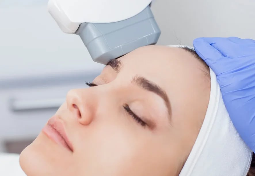 Patient with eyes closed as a gloved provider holds an IPL handpiece to her forehead