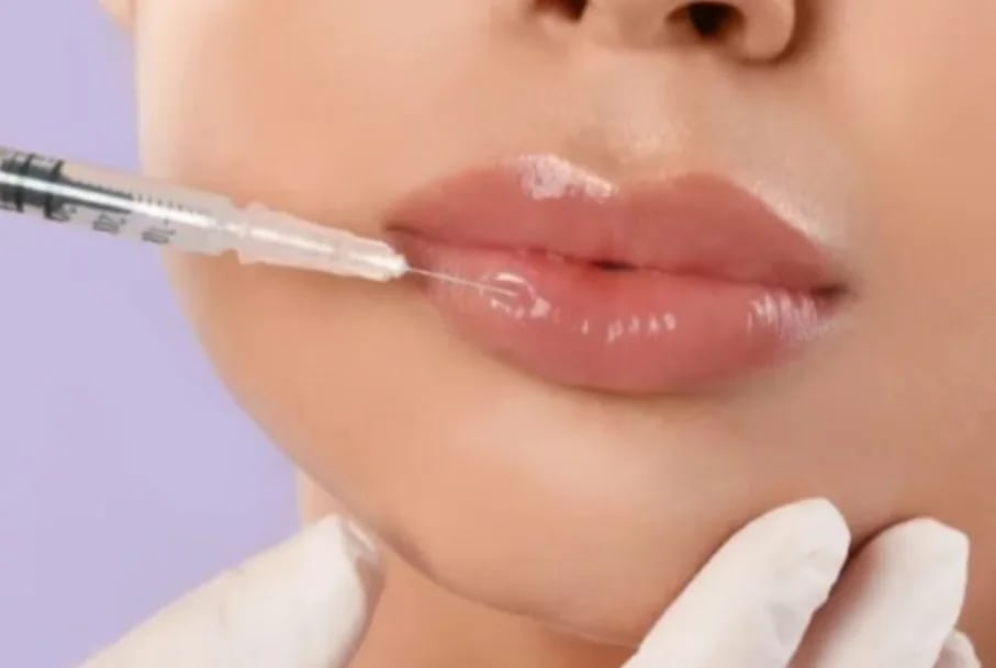 Close-up of a gloved hand steadying the chin while a needle injects filler into glossy lips